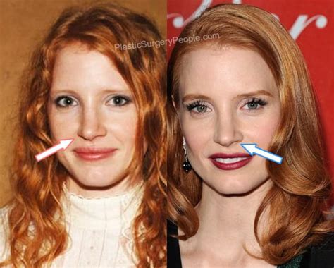 jessica chastain plastic surgery|Jessica Chastain on Having Red Hair, Trying Plastic。